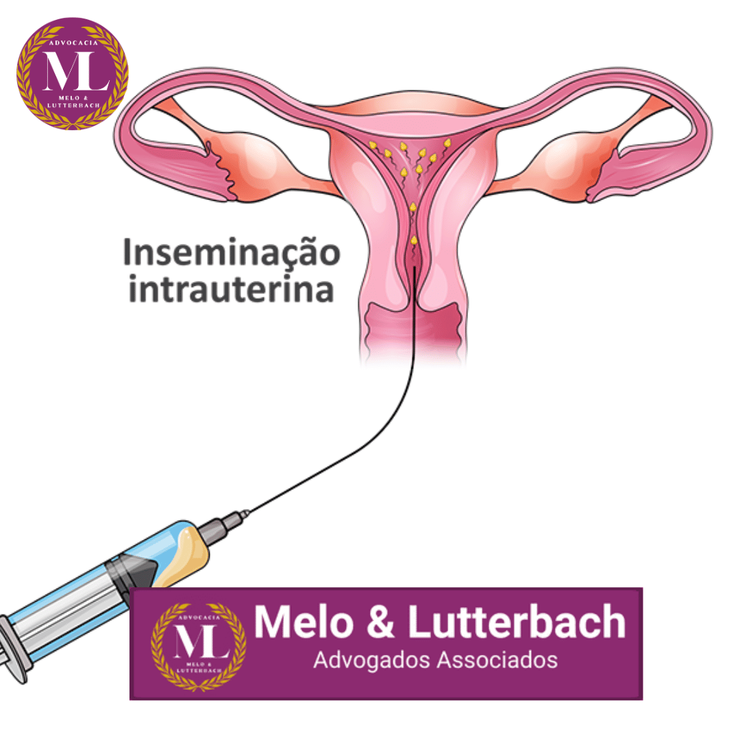 O Registro Civil de Filhos Gerados por Inseminação Caseira: Desafios Legais e a Proteção dos Direitos da Criança